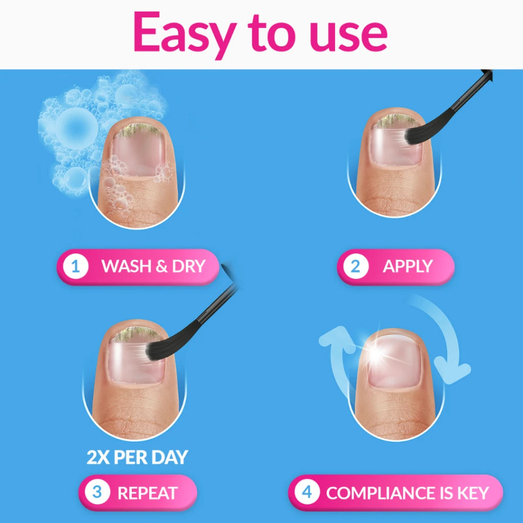 Excilor Treatment for Fungal Nail Infection