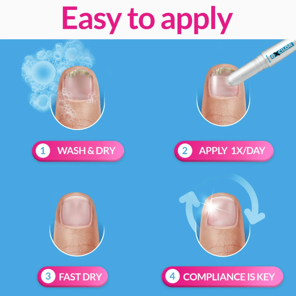 Excilor Nail Fungus Treatment Easy Pen 