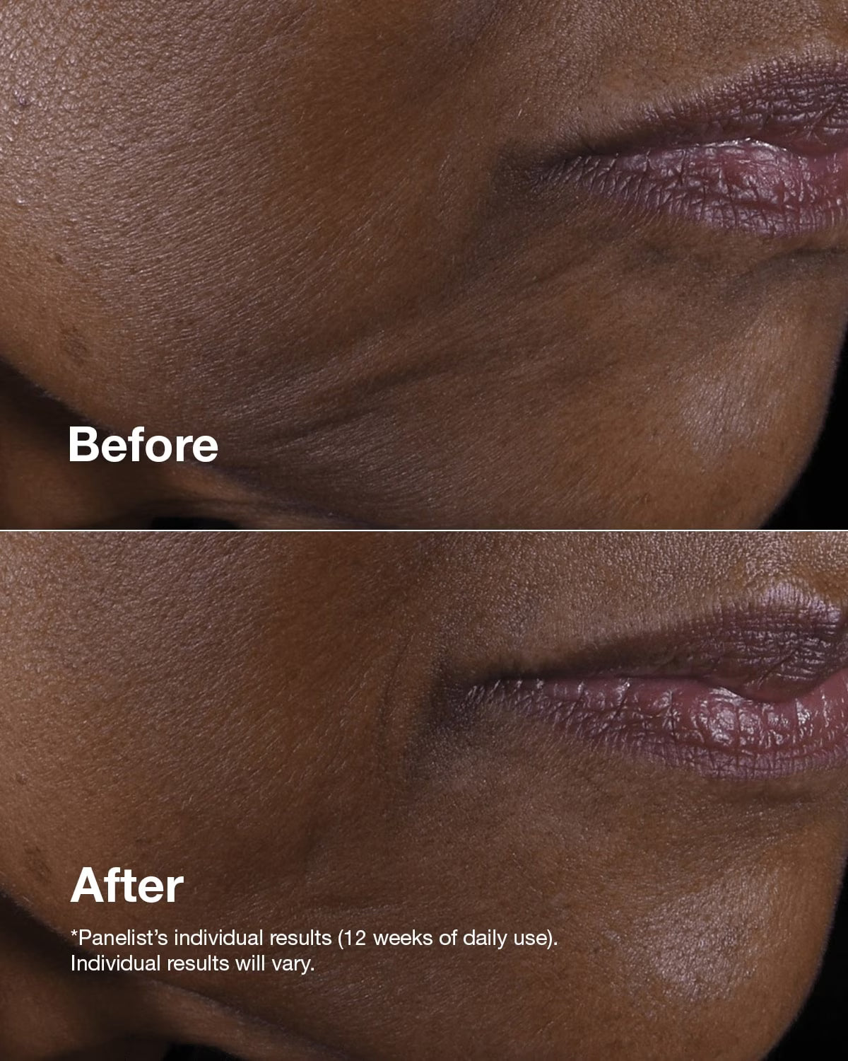 Clinique Smart Clinical Repair™ Lifting Face + Neck Cream Main 3