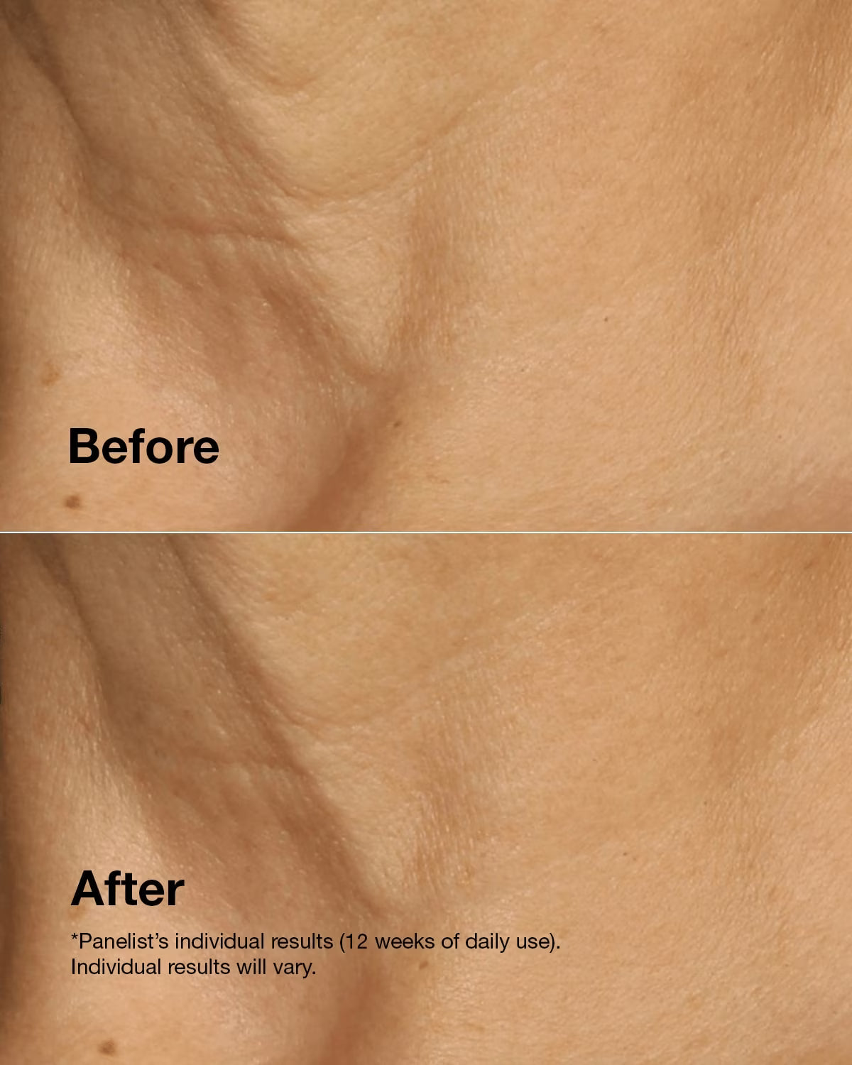 Clinique Smart Clinical Repair™ Lifting Face + Neck Cream Main 4