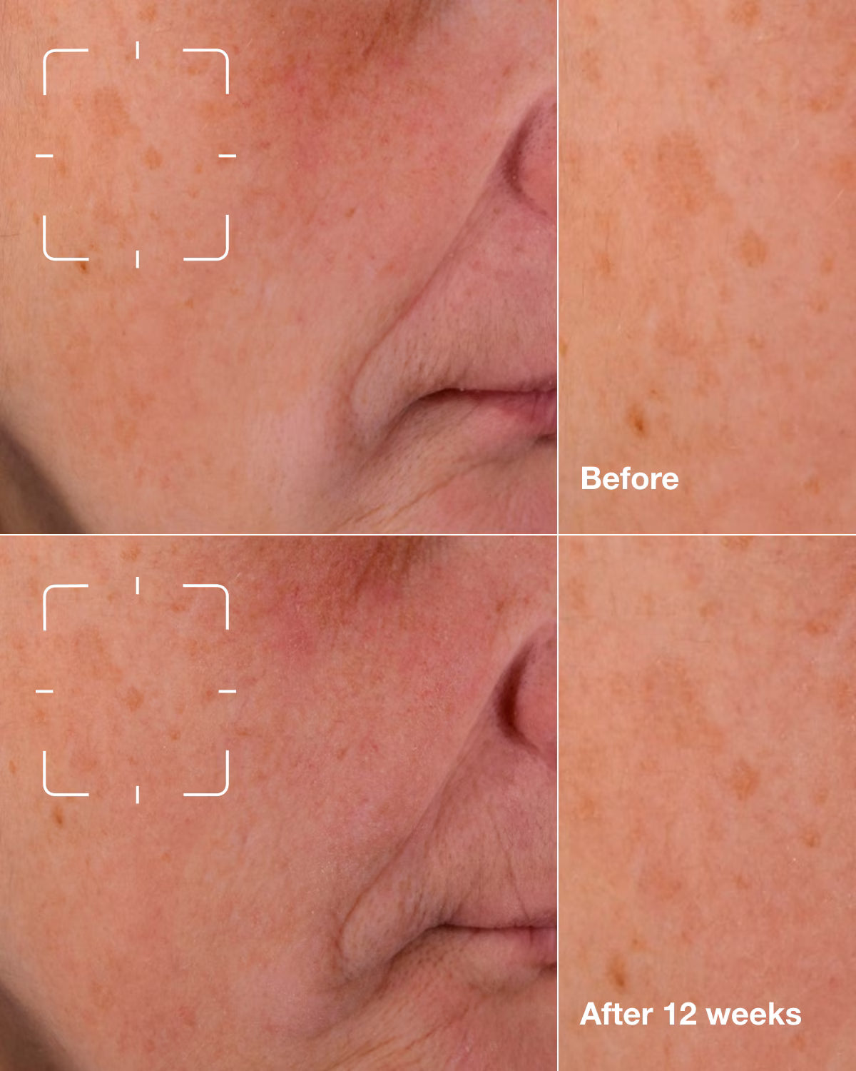 Clinique New Even Better Clinical™ Dark Spot Clearing Serum Primary 2
