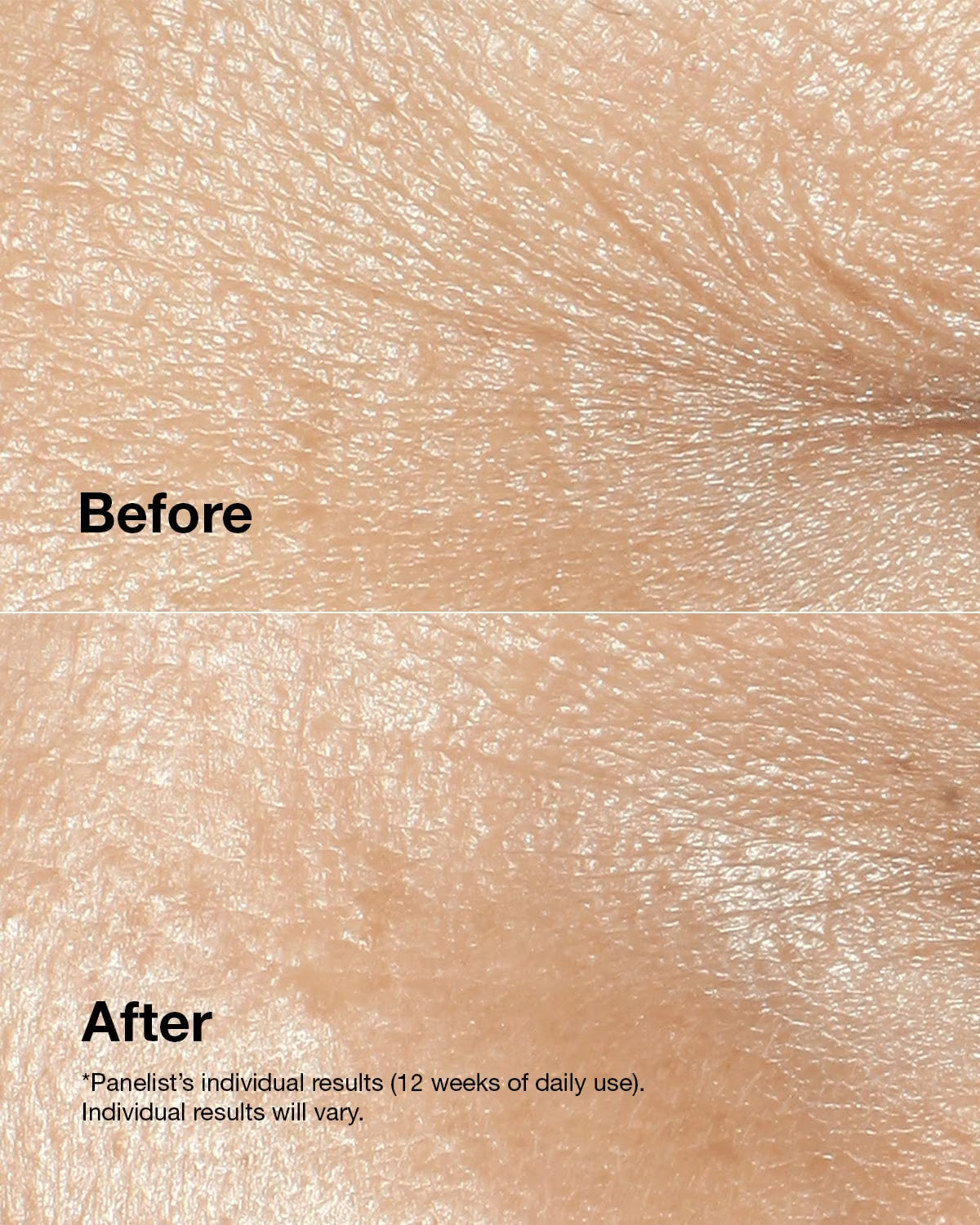 Clinique Smart Clinical Repair™ Wrinkle Correcting Cream Primary 2
