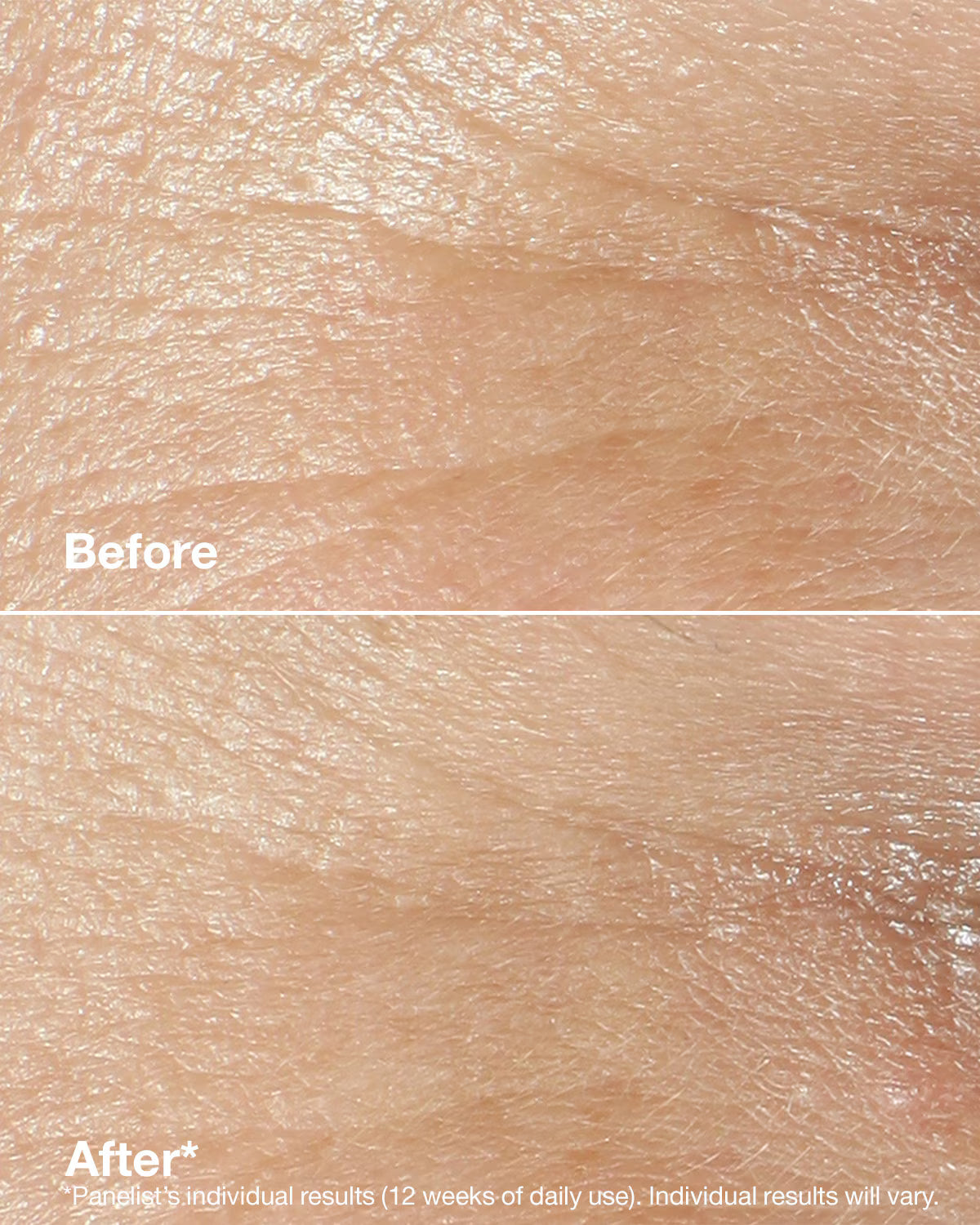 Clinique Smart Clinical Repair™ Wrinkle Correcting Rich Cream 50ml Primary 4
