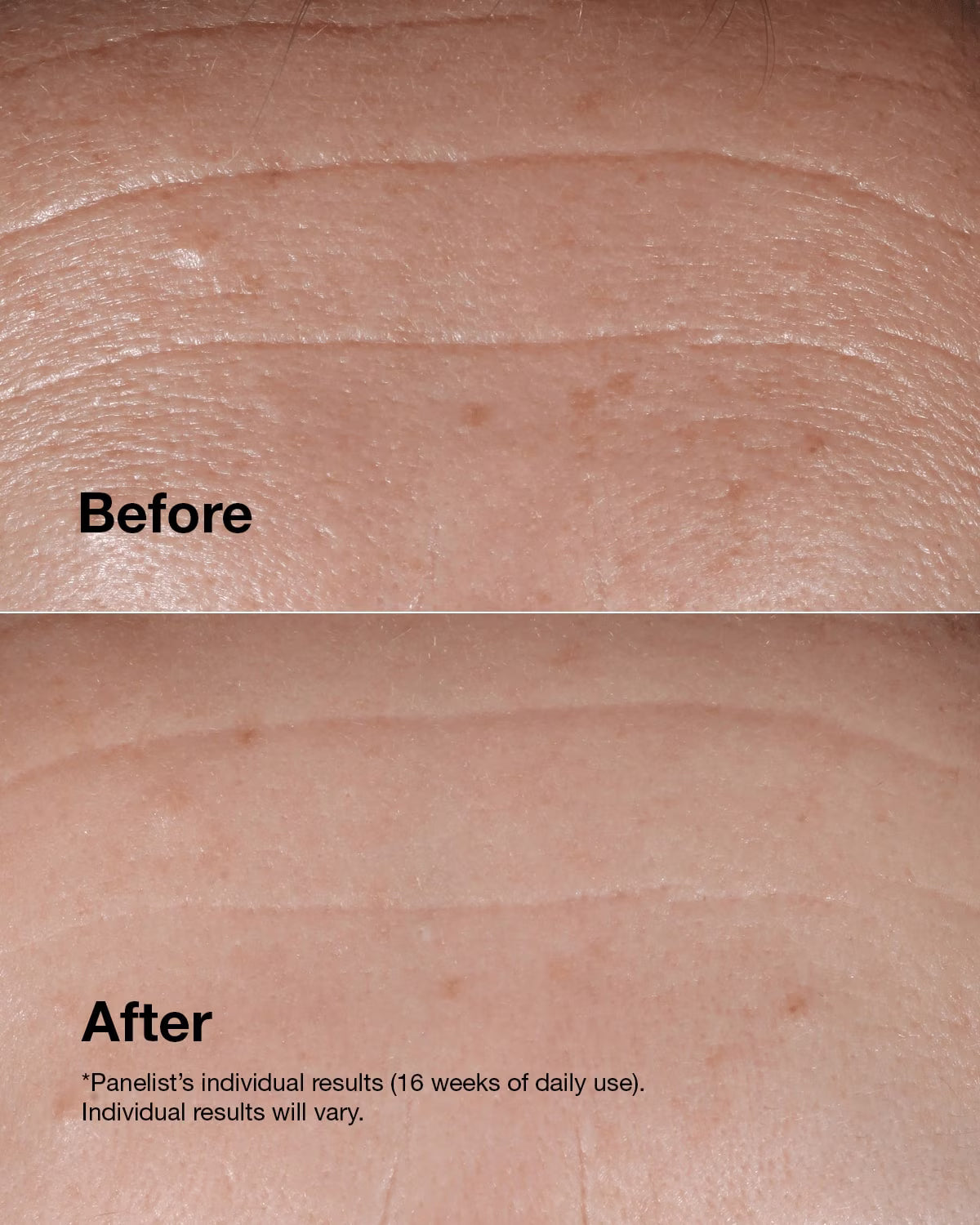 Clinique Smart Clinical Repair™ Wrinkle Correcting Serum Primary